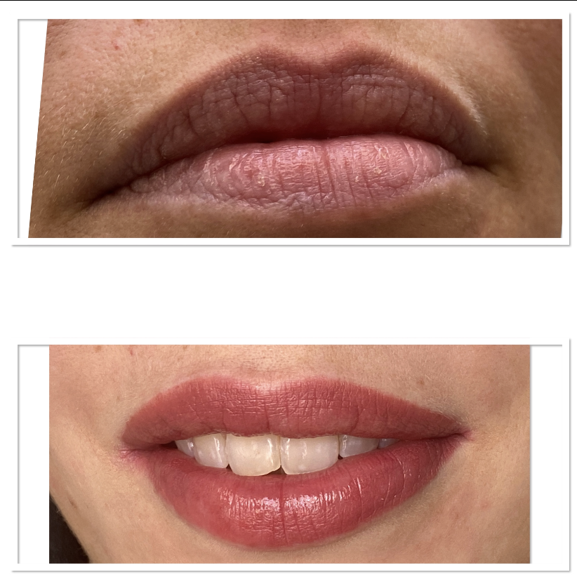 Permanent Makeup der Lippen - vorher/nachher